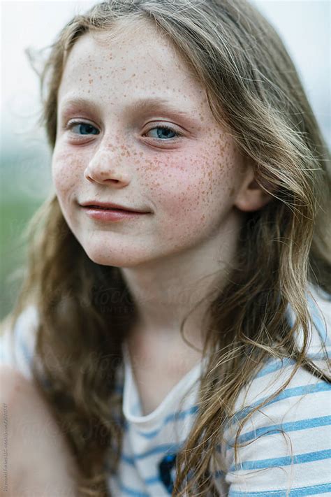 exploited teens freckles|Free Young Girl Freckles Photos